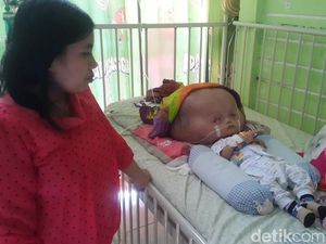 Farhan, Penderita Hydrocephalus di Banyuwangi Jalani Operasi Farhan, Penderita Hydrocephalus di Banyuwangi Jalani Operasi