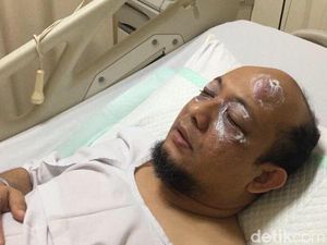 Novel di Singapura Sampai Sembuh, Bagaimana Penyidikan di KPK?