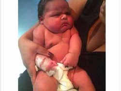 Wow, Besar Banget! Bayi Ini Lahir dengan Bobot 6 Kg