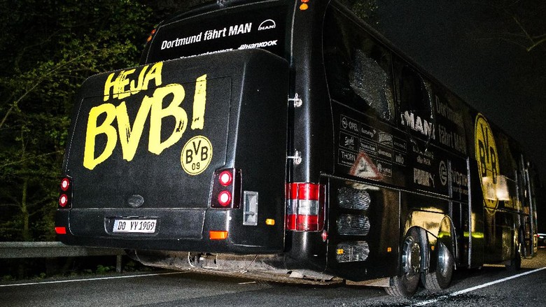 Bartra Tebar Senyuman Usai Jalani Operasi Akibat Terkena Dampak Ledakan Bartra Tebar Senyuman Usai Jalani Operasi Akibat Terkena Dampak Ledakan