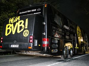 Bartra Tebar Senyuman Usai Jalani Operasi Akibat Terkena Dampak Ledakan Bartra Tebar Senyuman Usai Jalani Operasi Akibat Terkena Dampak Ledakan