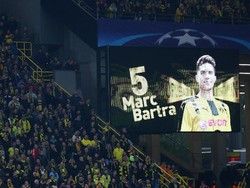 Bartra di Mana-Mana