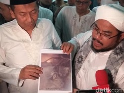 Soal Mobil Terbakar di Cawang, FPI Heran Polisi Datangnya Lama