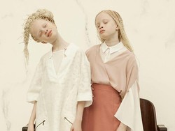 Kembar Albino Ini Tarik Perhatian Dunia dengan Kecantikannya yang Unik