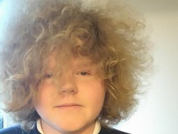 Botaki Kepala untuk Solidaritas Kanker, Siswa Inggris Dihukum