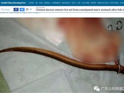 Astaga! Belut Dimasukkan ke Anus untuk Atasi Sembelit