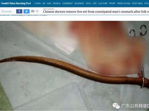 Astaga! Belut Dimasukkan ke Anus untuk Atasi Sembelit Astaga! Belut Dimasukkan ke Anus untuk Atasi Sembelit