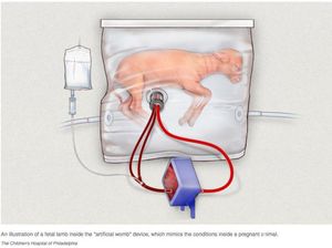 Kantong Transparan Ini adalah Rahim Buatan untuk Bayi Prematur