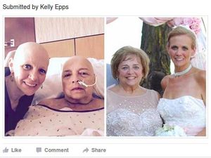 Berkat Sang Ibu, Wanita Ini Kembali Pede Meski Botak Pasca Dikemoterapi