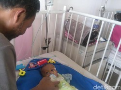 Cerita Lahirnya Srikandi, Bayi Gizi Buruk dari Ibu Gangguan Jiwa