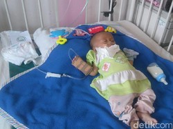 Srikandi, Bayi Gizi Buruk di Bandung Terlahir dari Ibu Gangguan Jiwa