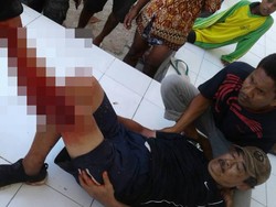 Turis yang Diserang Komodo Sempat Minta Tolong Dicarikan Ponselnya