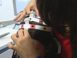 Aneka Terapi Setrum yang Diyakini Bermanfaat Bagi Kesehatan