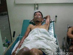 Tabung Gas Melon Bocor, 5 Pegawai Pabrik Tahu Alami Luka Bakar