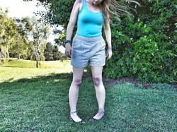 Punya Kondisi Langka, Wanita Ini Mudah Terkilir dan Cedera