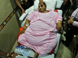 Operasi Kedua, Bobot Wanita Terberat di Dunia Turun Hingga 300 kg