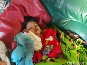 Nestapa Almira, Bocah Pangalengan Bandung Pengidap Tumor