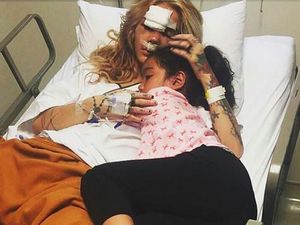 Kecelakaan Sampai Hidung Retak, Sheila Marcia Ingin Cepat Pulang