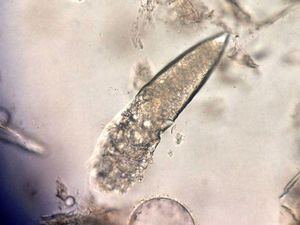 Wajah Kita Ternyata Tempat Bersarang Kutu!