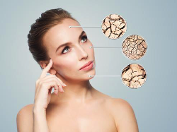 Cari Tahu Cara Mencegah Jerawat, Kulit Kusam, dan Kulit Kering di Sini