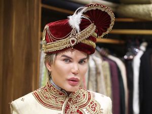 Pria Ini Operasi Plastik 58 Kali Demi Mirip Boneka Kekasih Barbie