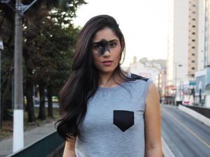 Foto: Kecantikan Mariana yang Punya Tanda Lahir Besar di Wajah