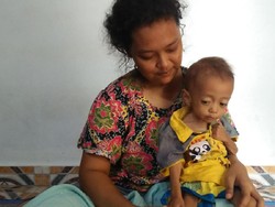 Kisah Dafa, Balita Pengidap Gizi Buruk di Cilegon