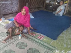 Luqman, Balita di Gunungkidul Derita Liver Kronis