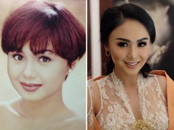 Foto: Imutnya Yuni Shara Menjelang Usia 45 Tapi Seperti Wanita 20-an