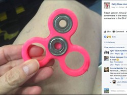 Hati-hati, Bagian Fidget Spinner Ini Bisa Bikin Tersedak
