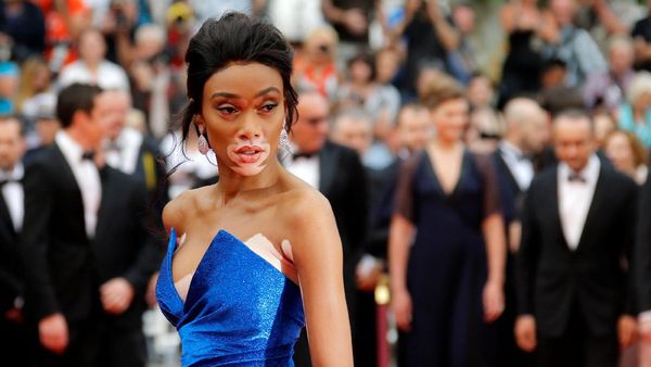 10 Perempuan Unik yang Berani Mendobrak Standar Kecantikan Dunia