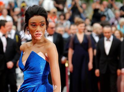 10 Perempuan Unik yang Berani Mendobrak Standar Kecantikan Dunia