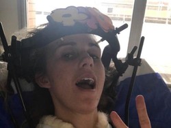 Duh, Wanita Ini Lehernya Patah Hanya karena Tertawa dan Bersin