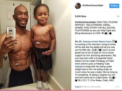 Viral, Foto Ayah dengan Anaknya yang Alami Gangguan Jantung Langka