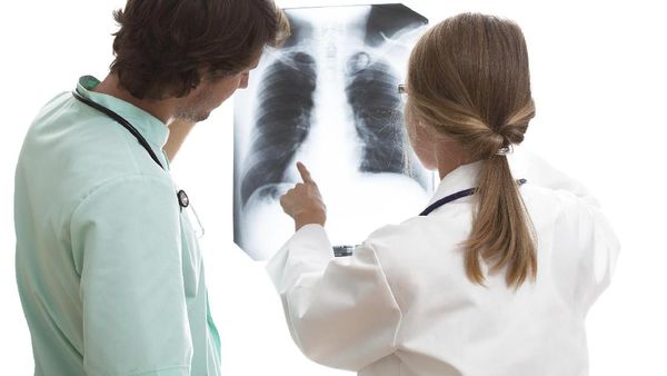 Berbagai Penyebab Kanker Paru Selain Rokok