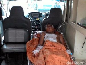 Bocah 12 Tahun di Cianjur Luka Bakar Terkena Ledakan Petasan Paralon