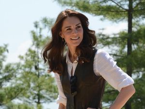 Hidung Kate Middleton Jadi Tren Operasi Plastik Paling Populer