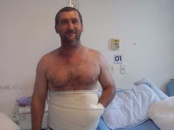 Cegah Infeksi, Tangan Pria Ini Dimasukkan ke dalam Perutnya