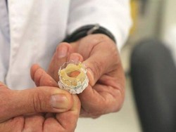 Kantung Jantung Sapi Dijadikan Implan Katup Jantung Manusia