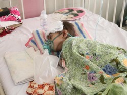 Kasihan, Bocah 4 Tahun di Aceh Alami Bocor Jantung dan Gizi Buruk