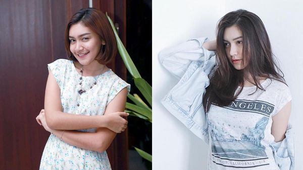 Makin Cantik, Melody Prima Dituduh Oplas