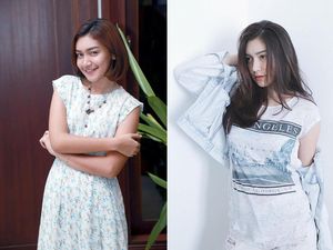 Makin Cantik, Melody Prima Dituduh Oplas