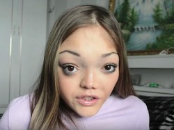 Kasihan, Wanita Ini Di-bully Jelek Karena Tulang Wajah Asimetris