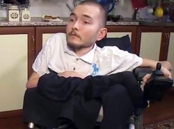 Fix! Transplantasi Kepala Valery Akan Dilakukan Akhir Tahun Ini