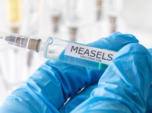 Lebih Menular dari Omicron, 1 Kasus Campak Bisa Sebarkan Virus ke 18 Orang Lebih Menular dari Omicron, 1 Kasus Campak Bisa Sebarkan Virus ke 18 Orang