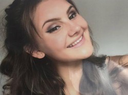 Gara-gara Alergi Susu, Gadis Ini Meninggal Setelah Makan Kebab