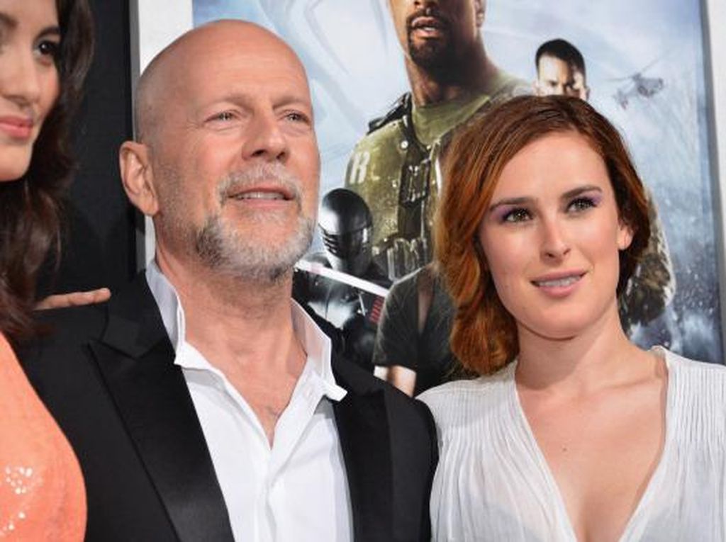 Mengenal Jenis-Jenis Afasia, Gangguan Otak yang Dialami Aktor Bruce Willis