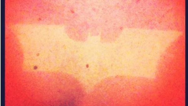 Kumpulan Foto Luka Bakar Terunik: Mulai dari Bunga Hingga Batman