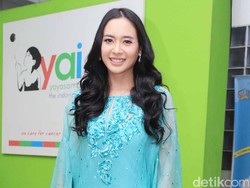 Cantik dan Seksi, Elvira Devinamira Banyak Dikira Barbie Hidup