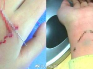 Ngeri! Muncul Tren Online Orang-orang Menyulam Kulitnya